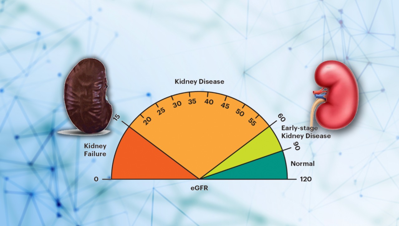 Kidney Function tests