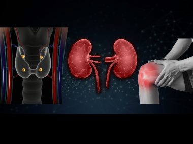 Bone pains and parathyroid hormone in CKD