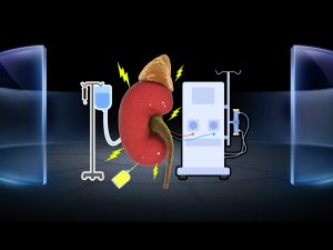 Residual Renal Function