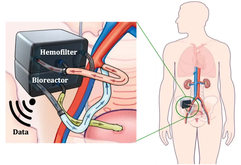 basic technology behind bioartificial kidney