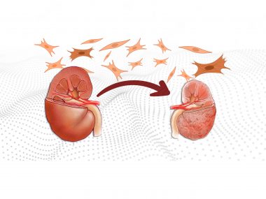 Chronic Kidney disease and fibrosis